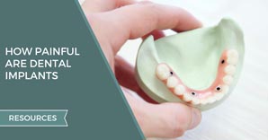 How Painful Are Dental Implants?