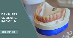 Dentures vs. Dental Implants